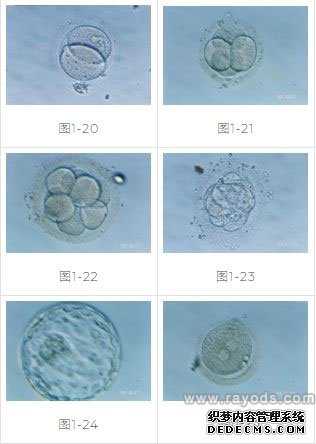 芜湖百城捐卵_试管婴儿胚胎移植具体过程及方式